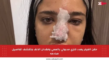 حقن الفيلر يهدد كنزي مدبولي بالعمى وفقدان الأنف وتكشف تفاصيل صادمة